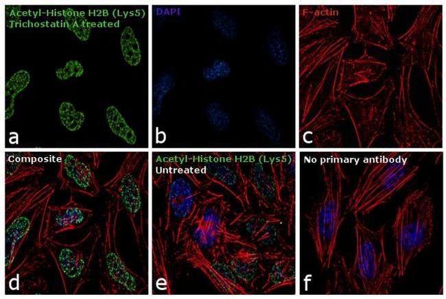 H2BK5ac Antibody in Immunocytochemistry (ICC/IF)