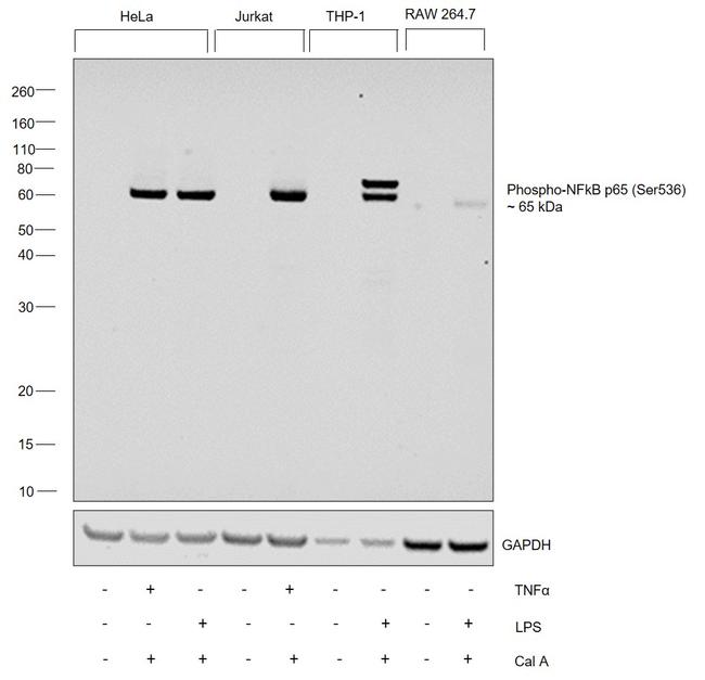 Phospho-NFkB p65 (Ser536) Antibody in Western Blot (WB)