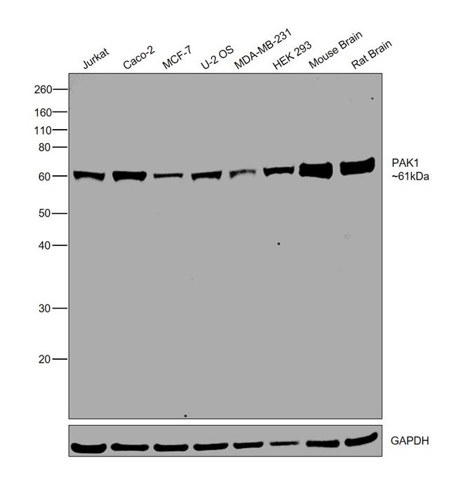 PAK1 Antibody in Western Blot (WB)