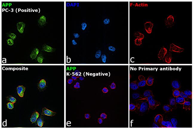 Amyloid Precursor Protein Antibody in Immunocytochemistry (ICC/IF)