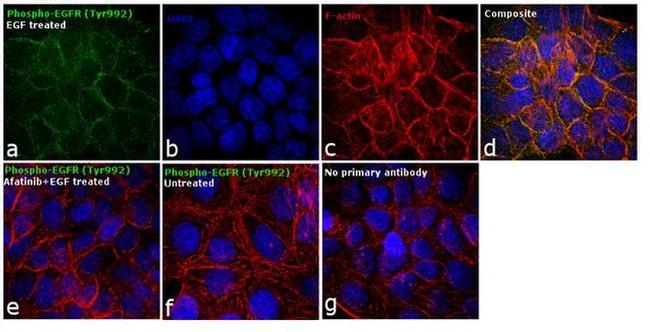 Phospho-EGFR (Tyr992) Antibody in Immunocytochemistry (ICC/IF)