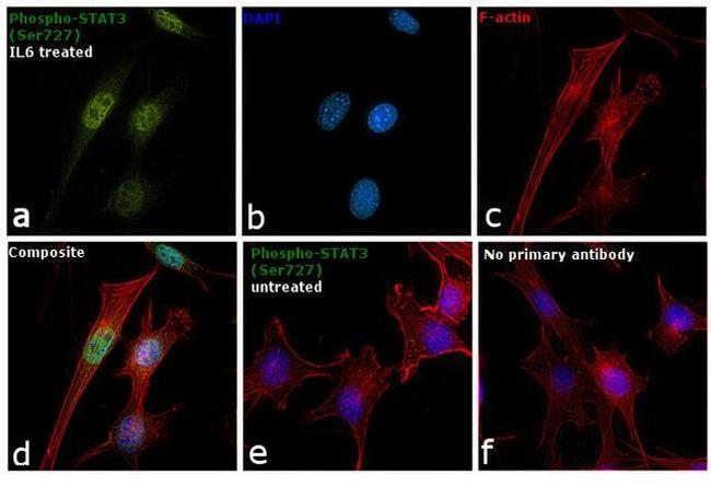 Phospho-STAT3 (Ser727) Antibody in Immunocytochemistry (ICC/IF)