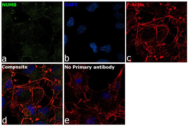 NUMB Antibody in Immunocytochemistry (ICC/IF)