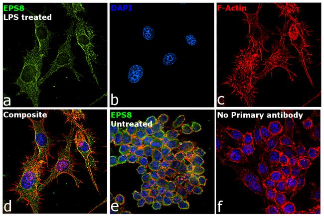 EPS8 Antibody in Immunocytochemistry (ICC/IF)