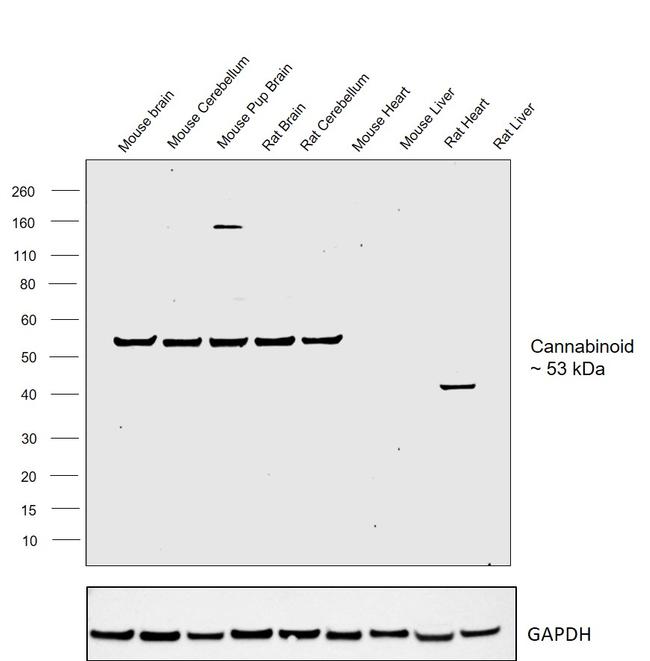 Cannabinoid Receptor 1 Antibody in Western Blot (WB)