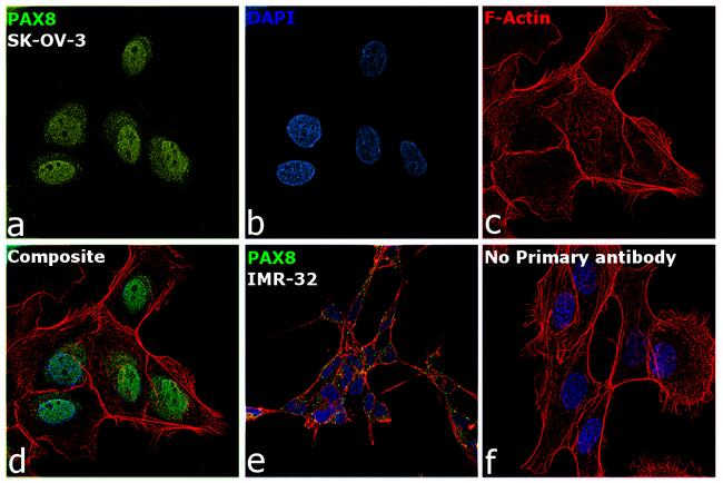 PAX8 Antibody in Immunocytochemistry (ICC/IF)