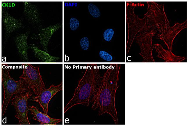 CK1 delta Antibody in Immunocytochemistry (ICC/IF)