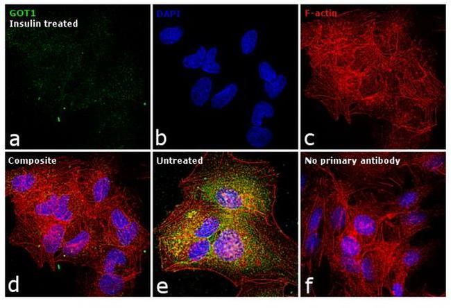 GOT1 Antibody in Immunocytochemistry (ICC/IF)