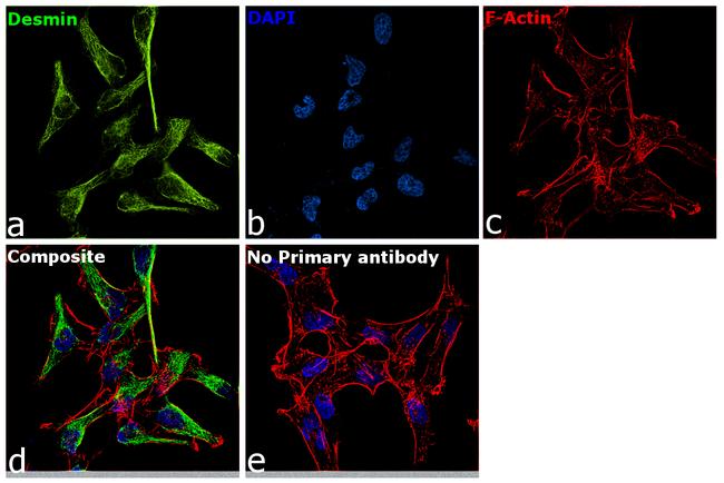 Desmin Antibody in Immunocytochemistry (ICC/IF)