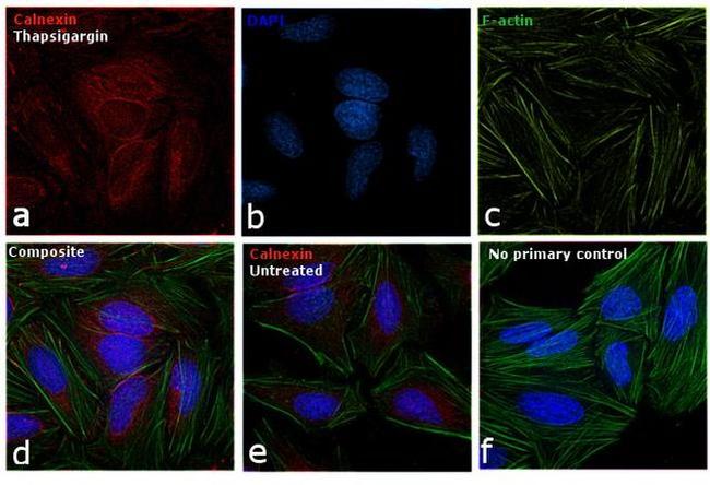 Calnexin Antibody in Immunocytochemistry (ICC/IF)