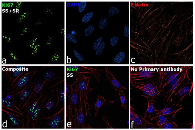 Ki-67 Antibody in Immunocytochemistry (ICC/IF)