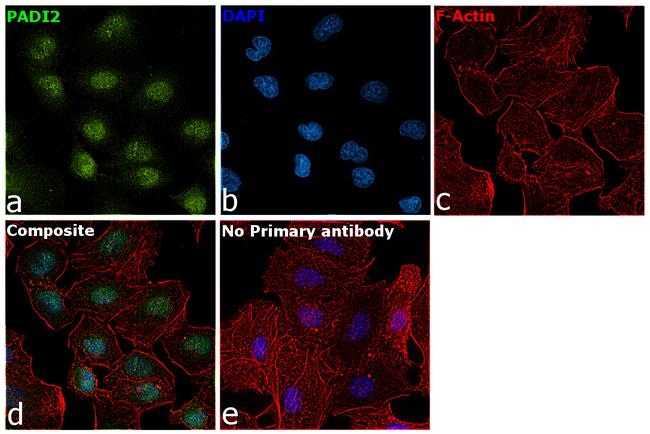 PADI2 Antibody in Immunocytochemistry (ICC/IF)