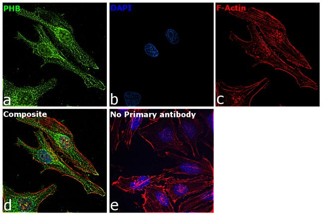 Prohibitin Antibody in Immunocytochemistry (ICC/IF)