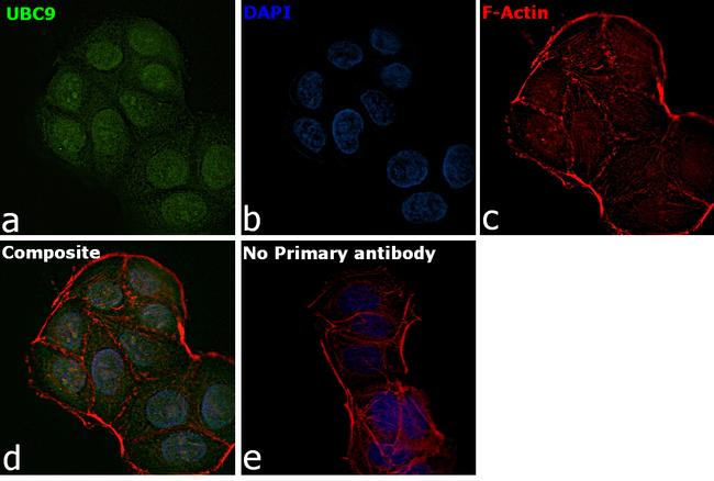 UBC9 Antibody in Immunocytochemistry (ICC/IF)