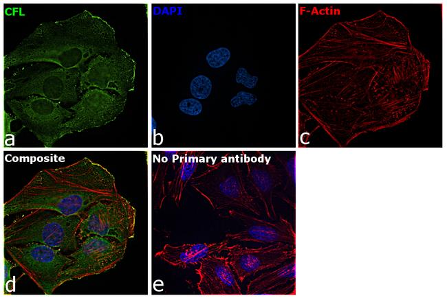 Cofilin Antibody in Immunocytochemistry (ICC/IF)