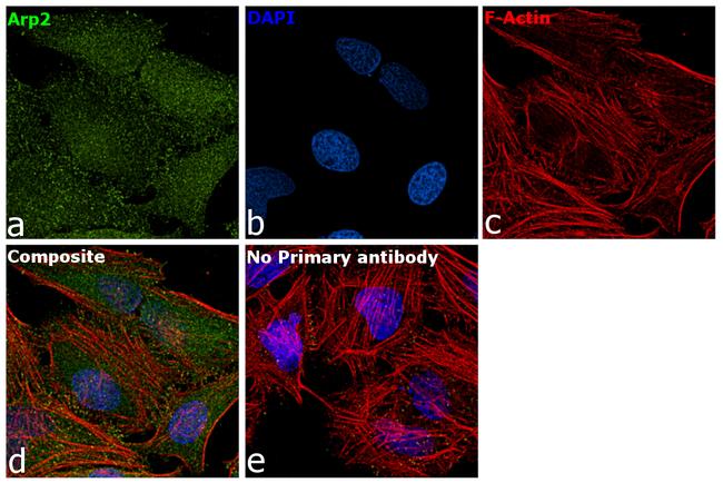 Arp2 Antibody in Immunocytochemistry (ICC/IF)