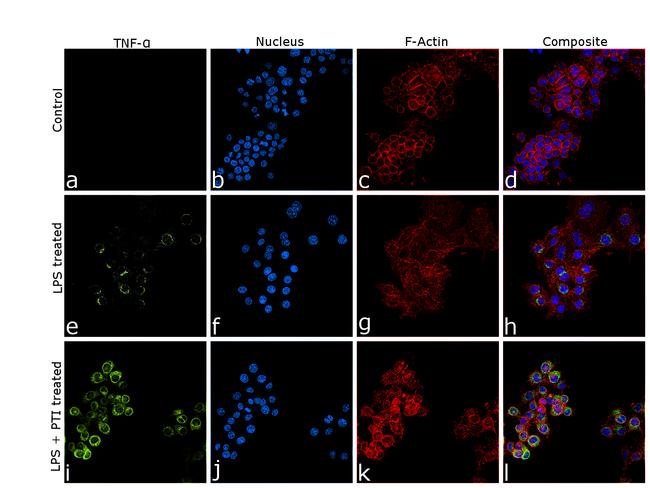 TNF alpha Antibody in Immunocytochemistry (ICC/IF)