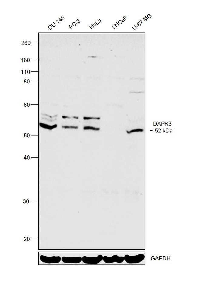 ZIPK Antibody in Western Blot (WB)