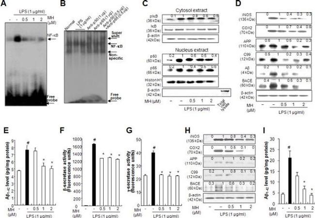 Amyloid Precursor Protein Antibody in Western Blot (WB)