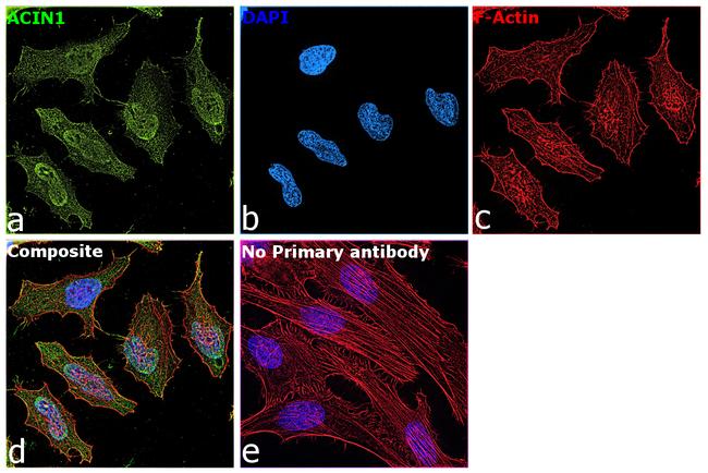 Acinus Antibody in Immunocytochemistry (ICC/IF)