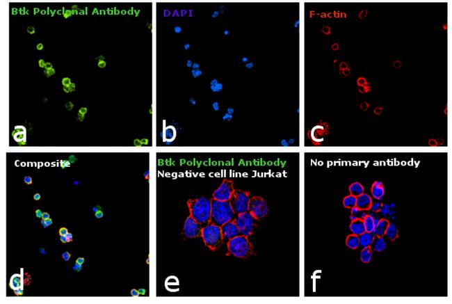 Btk Antibody in Immunocytochemistry (ICC/IF)