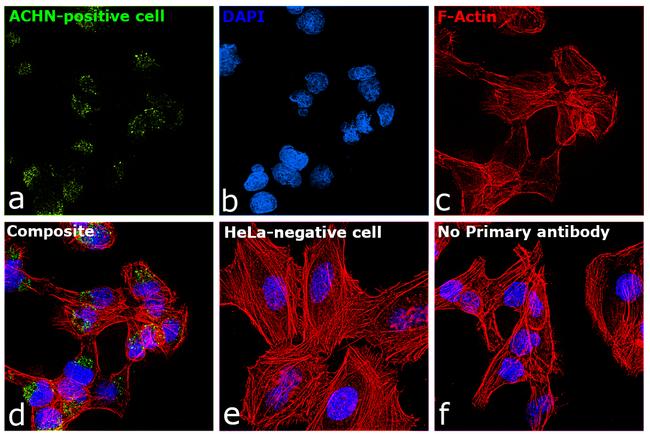 TIM-1 Antibody in Immunocytochemistry (ICC/IF)