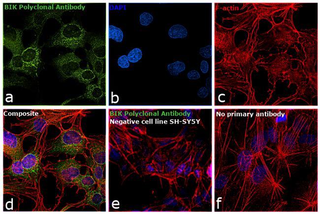 BIK Antibody in Immunocytochemistry (ICC/IF)