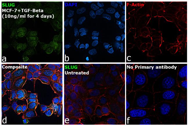 SLUG Antibody in Immunocytochemistry (ICC/IF)