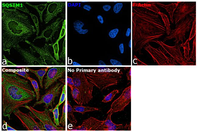 SQSTM1 Antibody in Immunocytochemistry (ICC/IF)