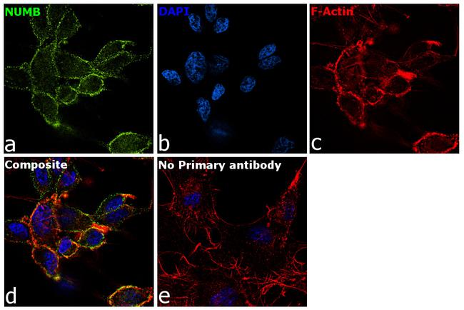 NUMB Antibody in Immunocytochemistry (ICC/IF)