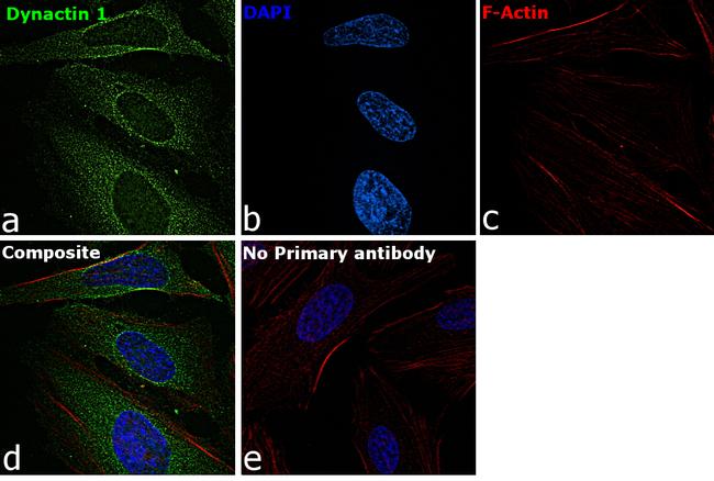 Dynactin 1 Antibody in Immunocytochemistry (ICC/IF)