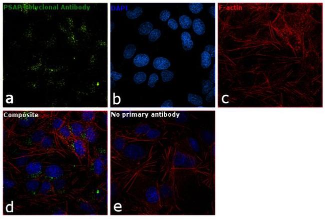 PSAP Antibody in Immunocytochemistry (ICC/IF)