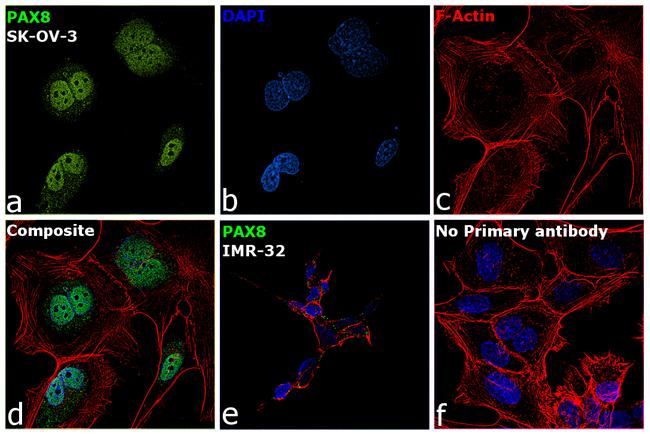 PAX8 Antibody in Immunocytochemistry (ICC/IF)