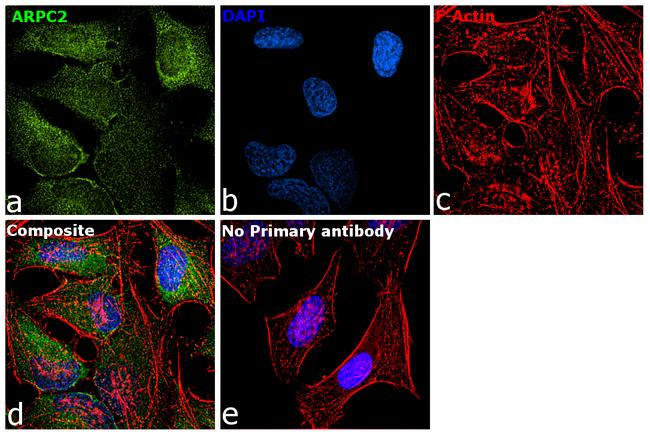 ARPC2 Antibody in Immunocytochemistry (ICC/IF)