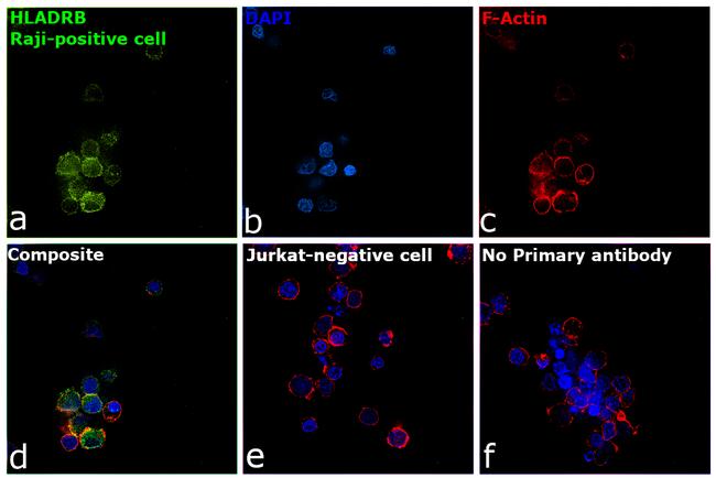 HLA-DR beta Antibody in Immunocytochemistry (ICC/IF)