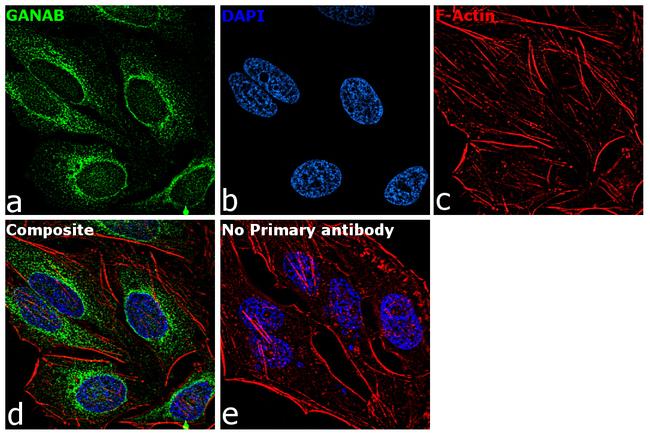 GANAB Antibody in Immunocytochemistry (ICC/IF)