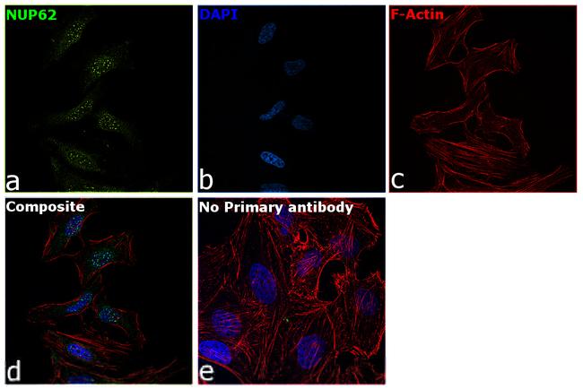 NUP62 Antibody in Immunocytochemistry (ICC/IF)