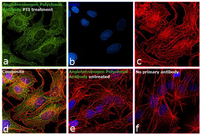 Angiotensinogen Antibody in Immunocytochemistry (ICC/IF)