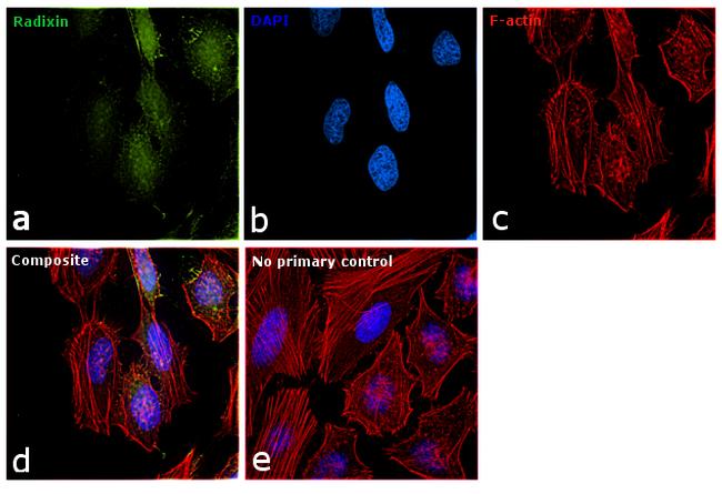 Radixin Antibody in Immunocytochemistry (ICC/IF)