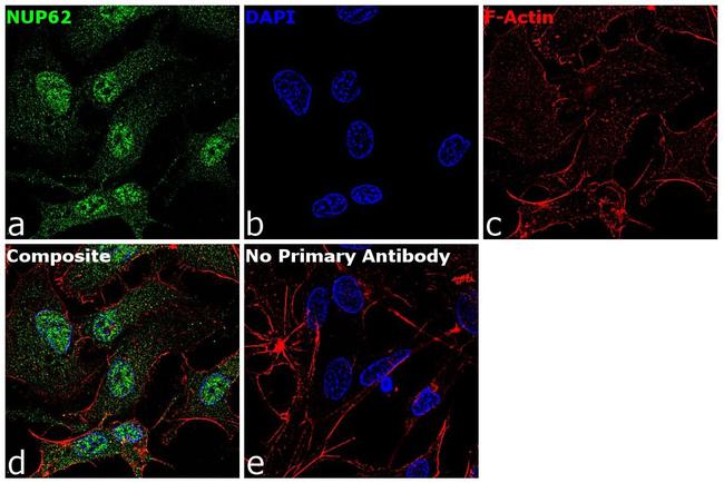 NUP62 Antibody in Immunocytochemistry (ICC/IF)