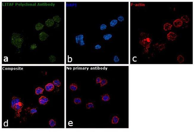 LITAF Antibody in Immunocytochemistry (ICC/IF)