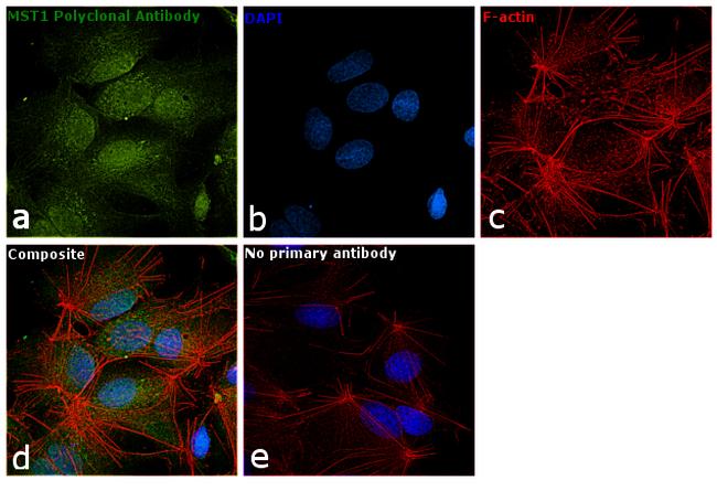 MST1 (STK4) Antibody in Immunocytochemistry (ICC/IF)