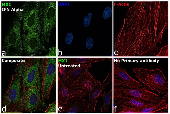 MX1 Antibody in Immunocytochemistry (ICC/IF)