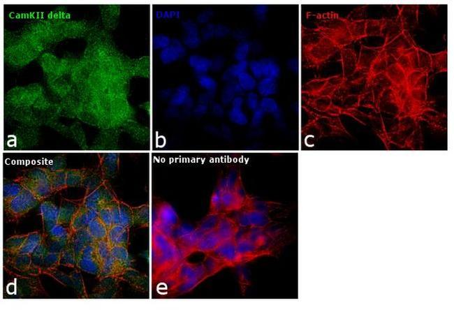 CaMKII delta Antibody in Immunocytochemistry (ICC/IF)