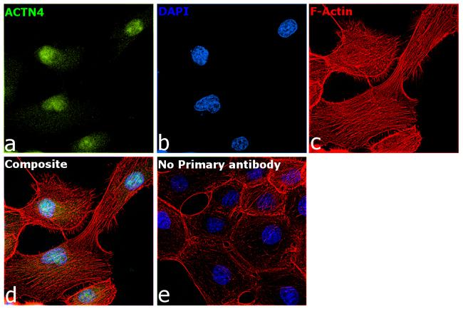 alpha Actinin 4 Antibody in Immunocytochemistry (ICC/IF)