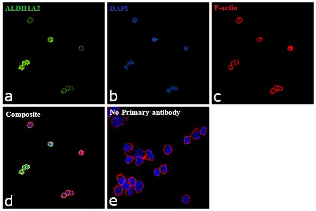 ALDH1A2 Antibody in Immunocytochemistry (ICC/IF)