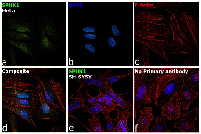 SPHK1 Antibody in Immunocytochemistry (ICC/IF)