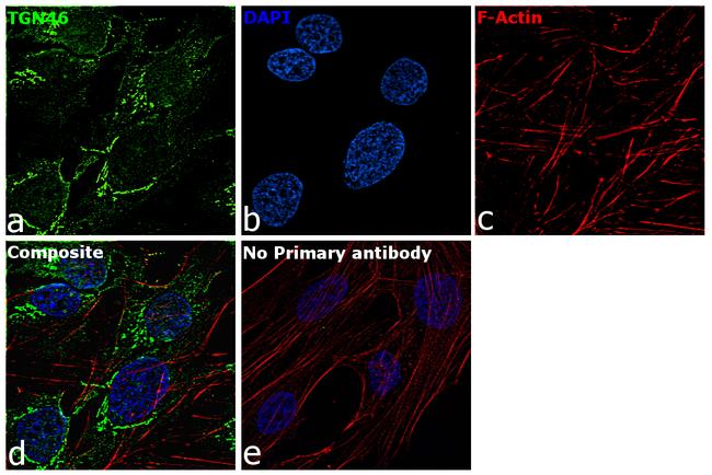 TGN46 Antibody in Immunocytochemistry (ICC/IF)