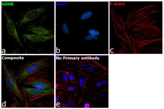 SDHB Antibody in Immunocytochemistry (ICC/IF)