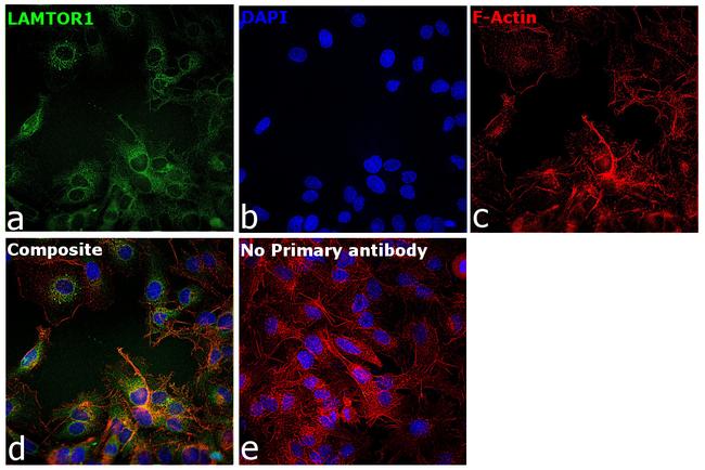 LAMTOR1 Antibody in Immunocytochemistry (ICC/IF)